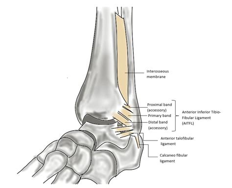 test for interosseous membrane tear|Syndesmotic Injuries Of The Ankle .